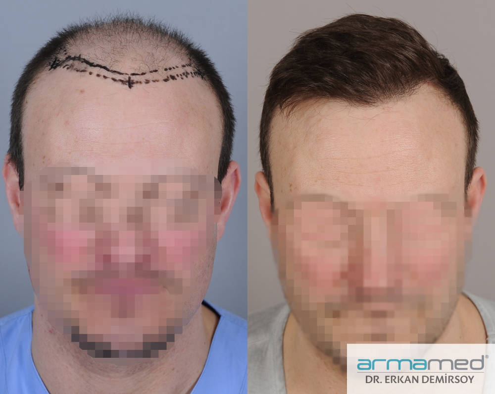 index.php/fa/29747/0/