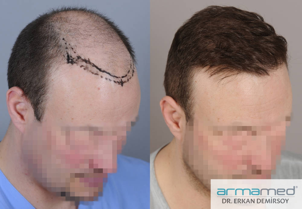 index.php/fa/29751/0/