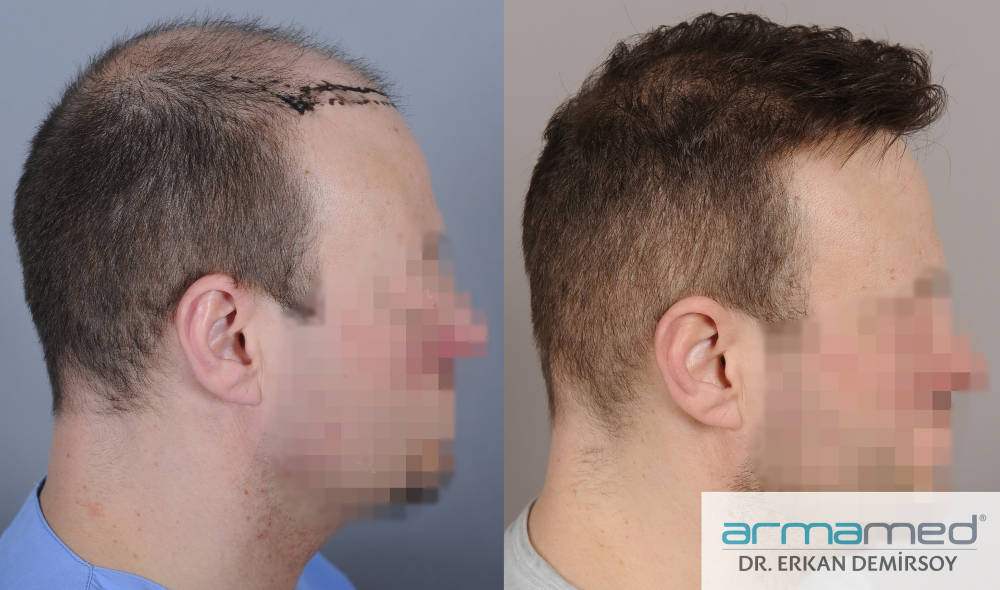 index.php/fa/29752/0/