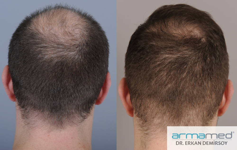 index.php/fa/29753/0/