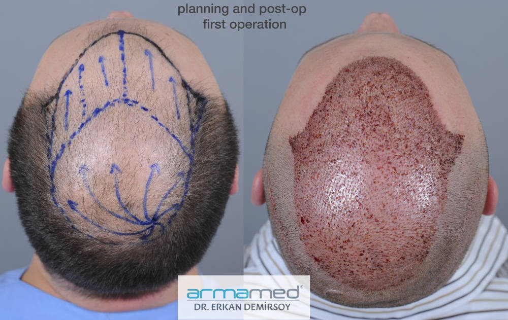 index.php/fa/29761/0/