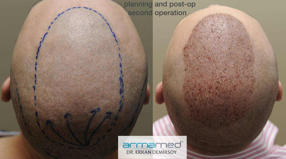 index.php/fa/29762/0/