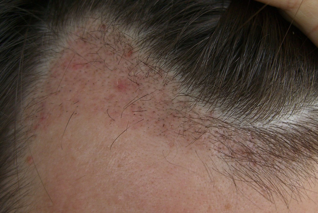 index.php/fa/2998/0/