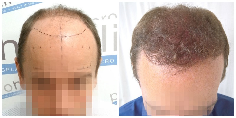 index.php/fa/30150/0/