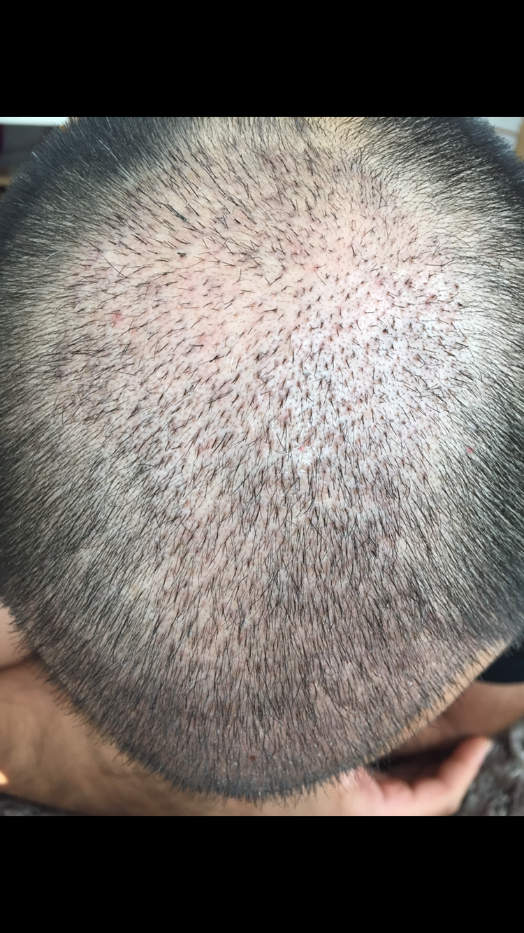 index.php/fa/30155/0/