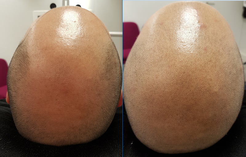 index.php/fa/30330/0/