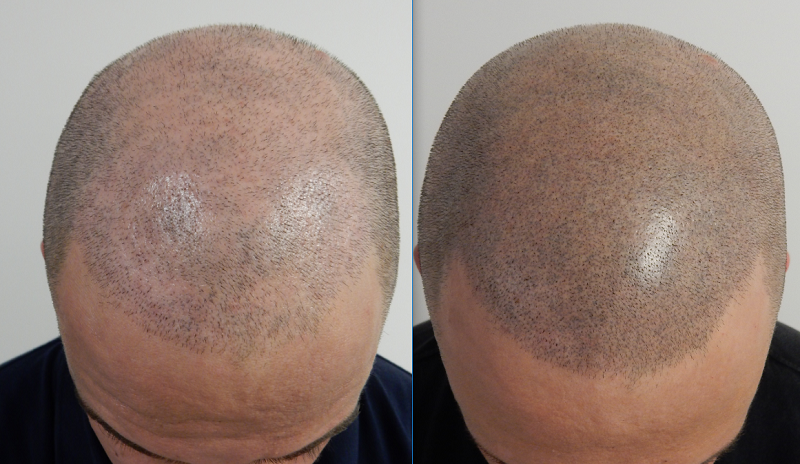 index.php/fa/30428/0/