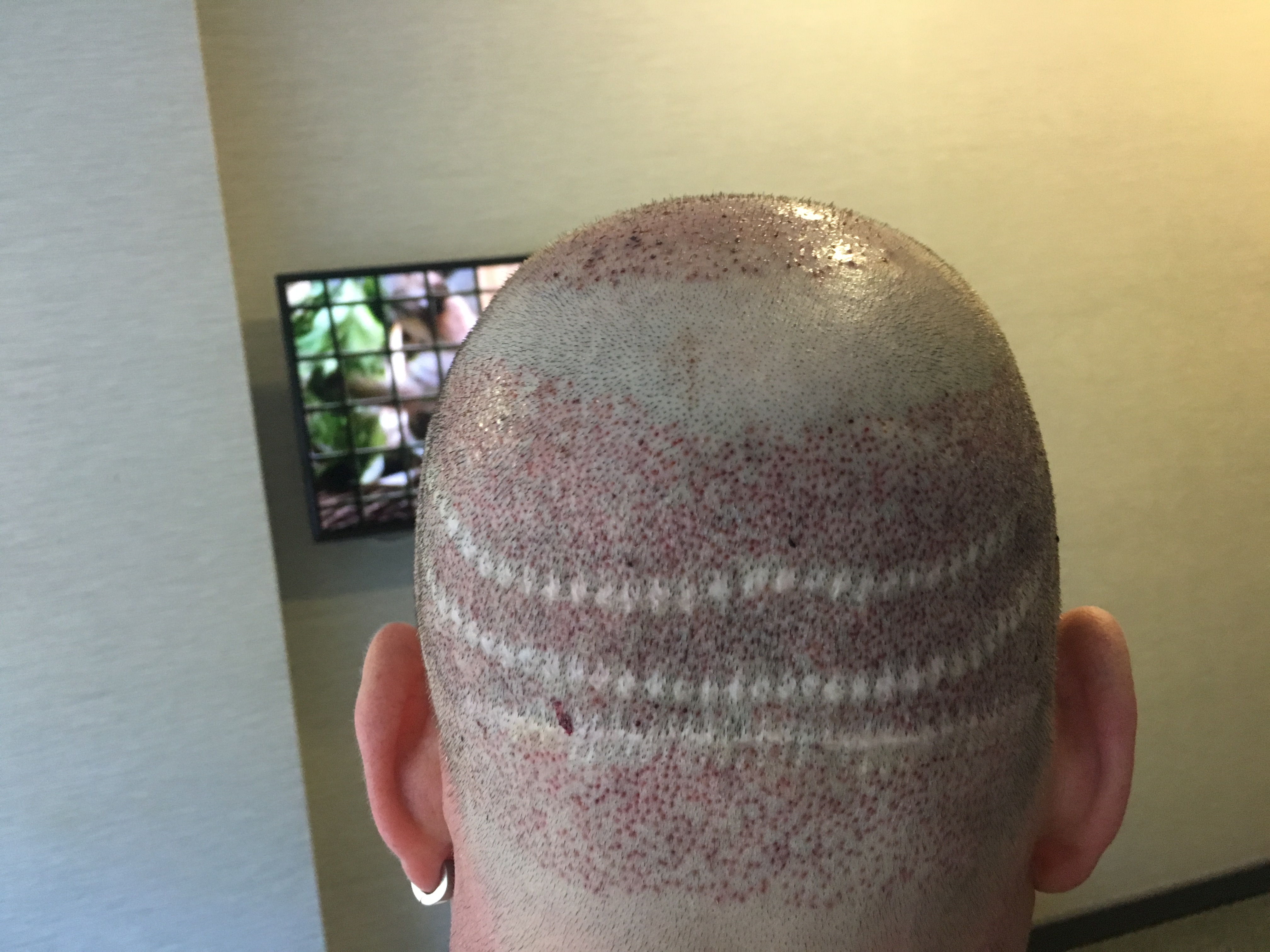 index.php/fa/30644/0/