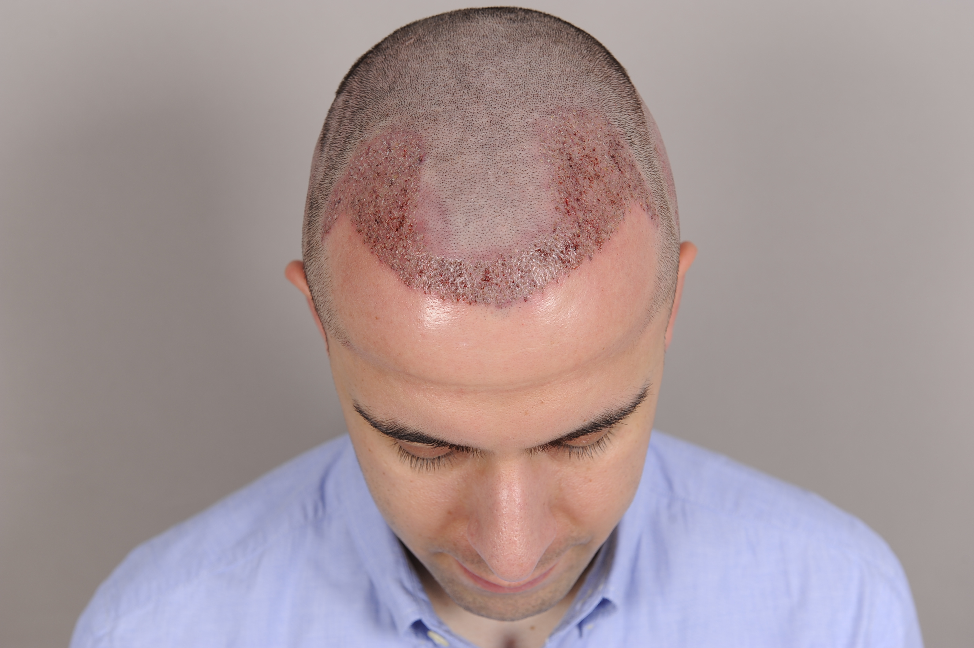 index.php/fa/30878/0/