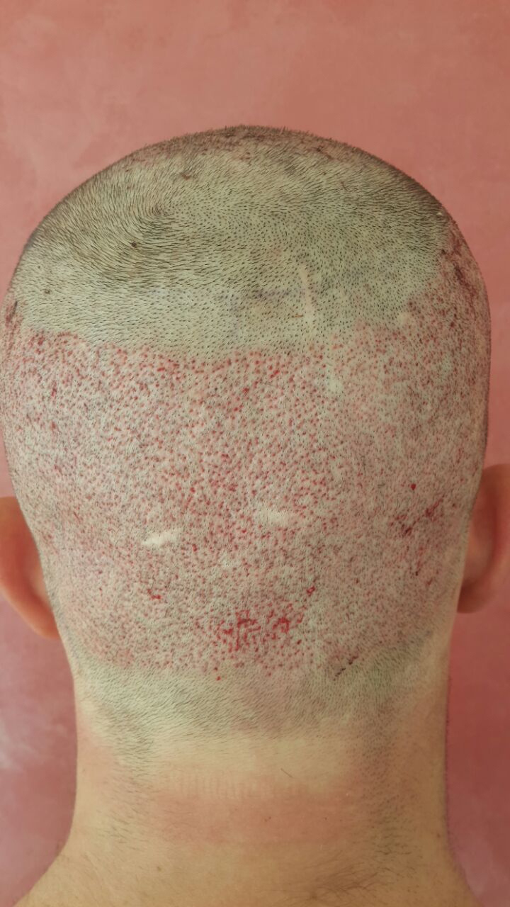 index.php/fa/30928/0/