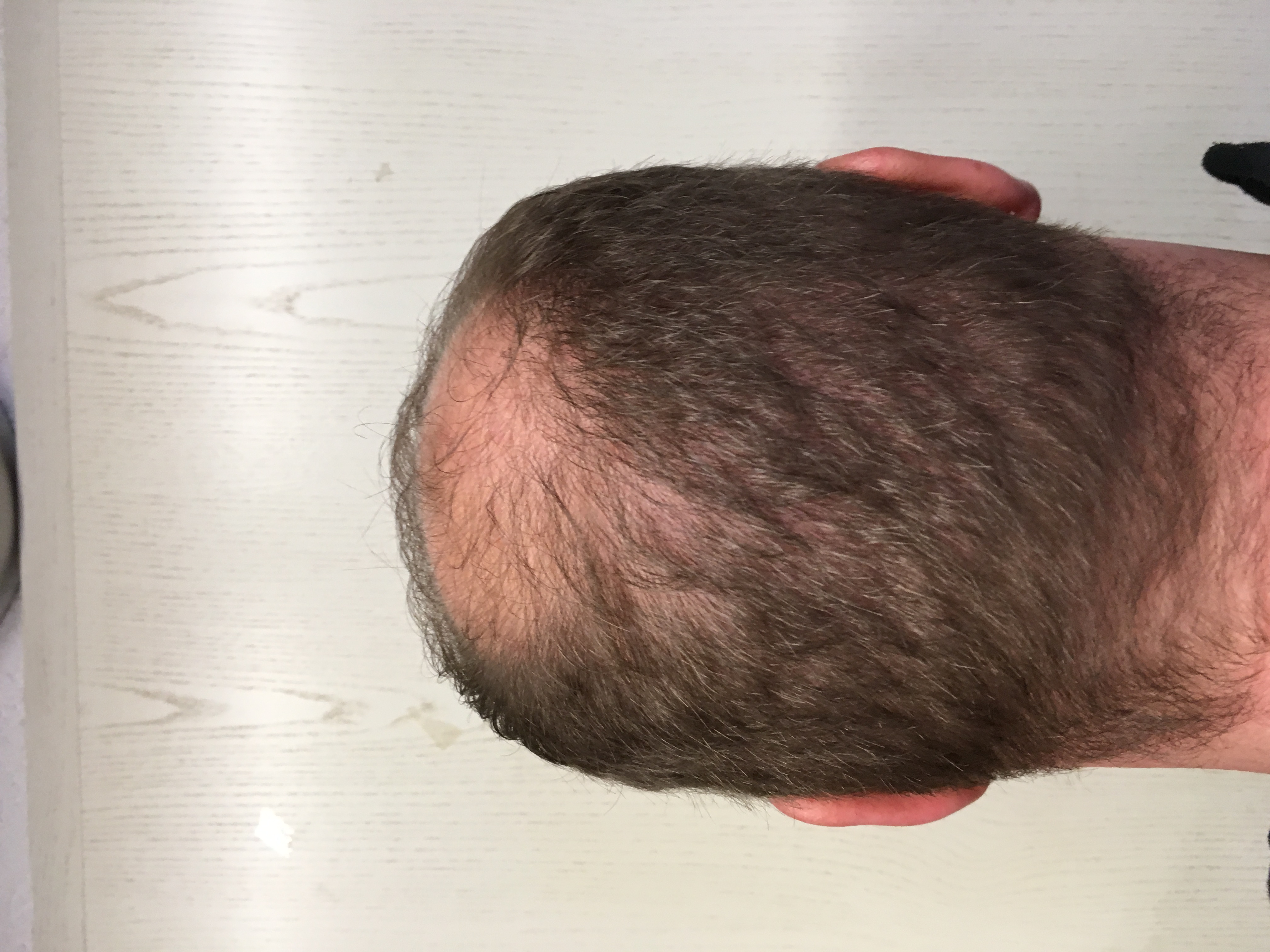 index.php/fa/31044/0/