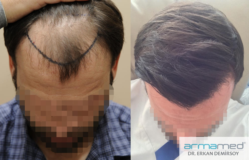 index.php/fa/31124/0/