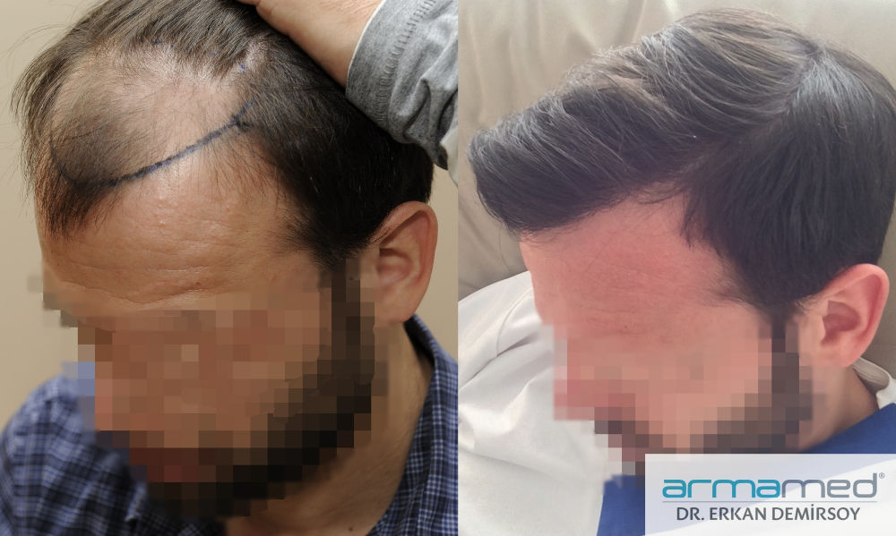 index.php/fa/31127/0/