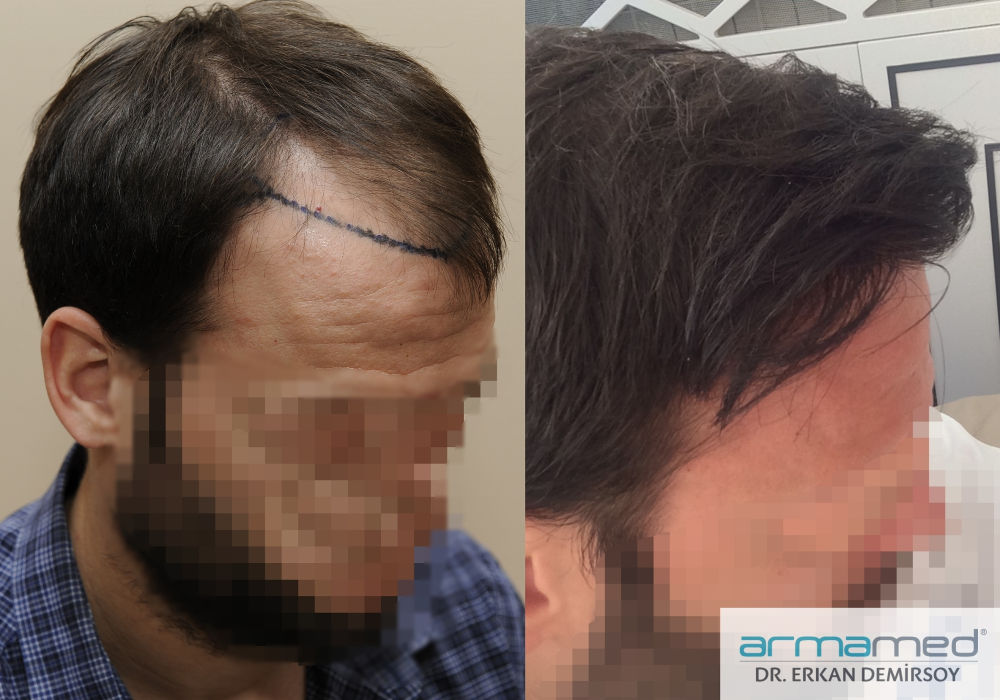 index.php/fa/31128/0/