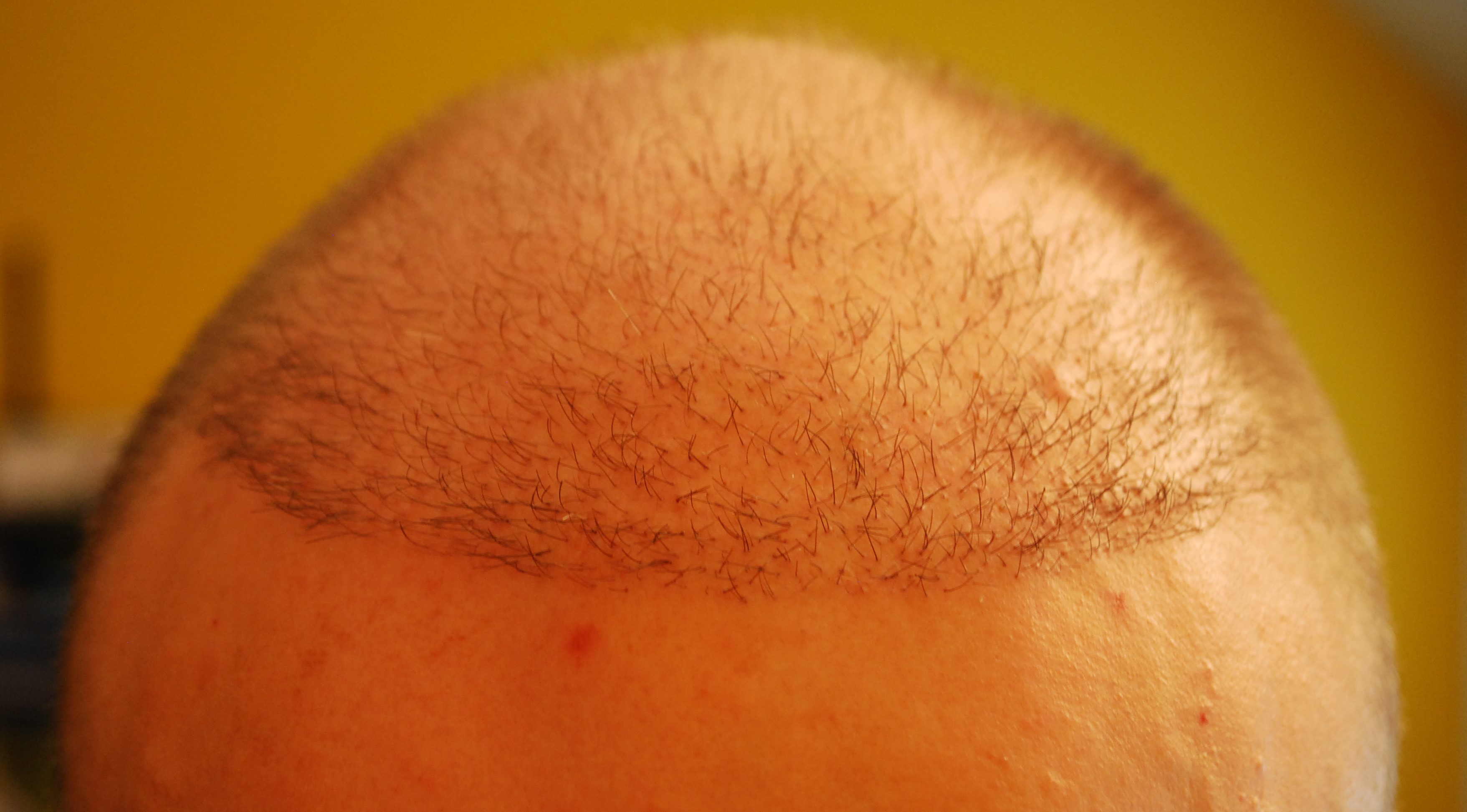 index.php/fa/31298/0/