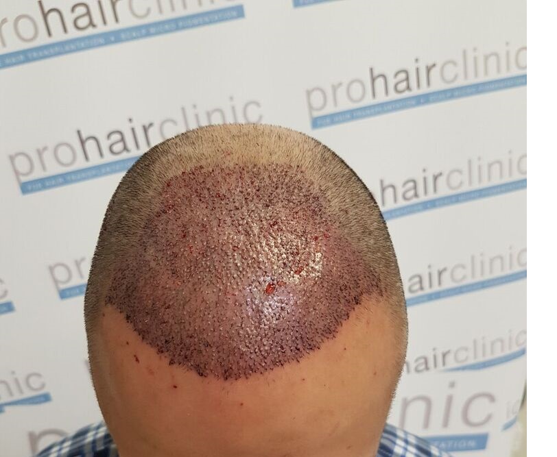 index.php/fa/31338/0/