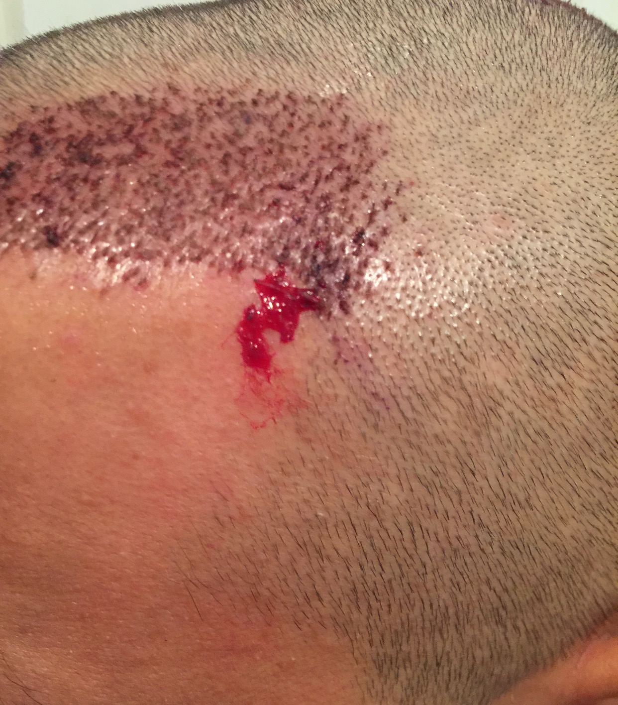 index.php/fa/31435/0/