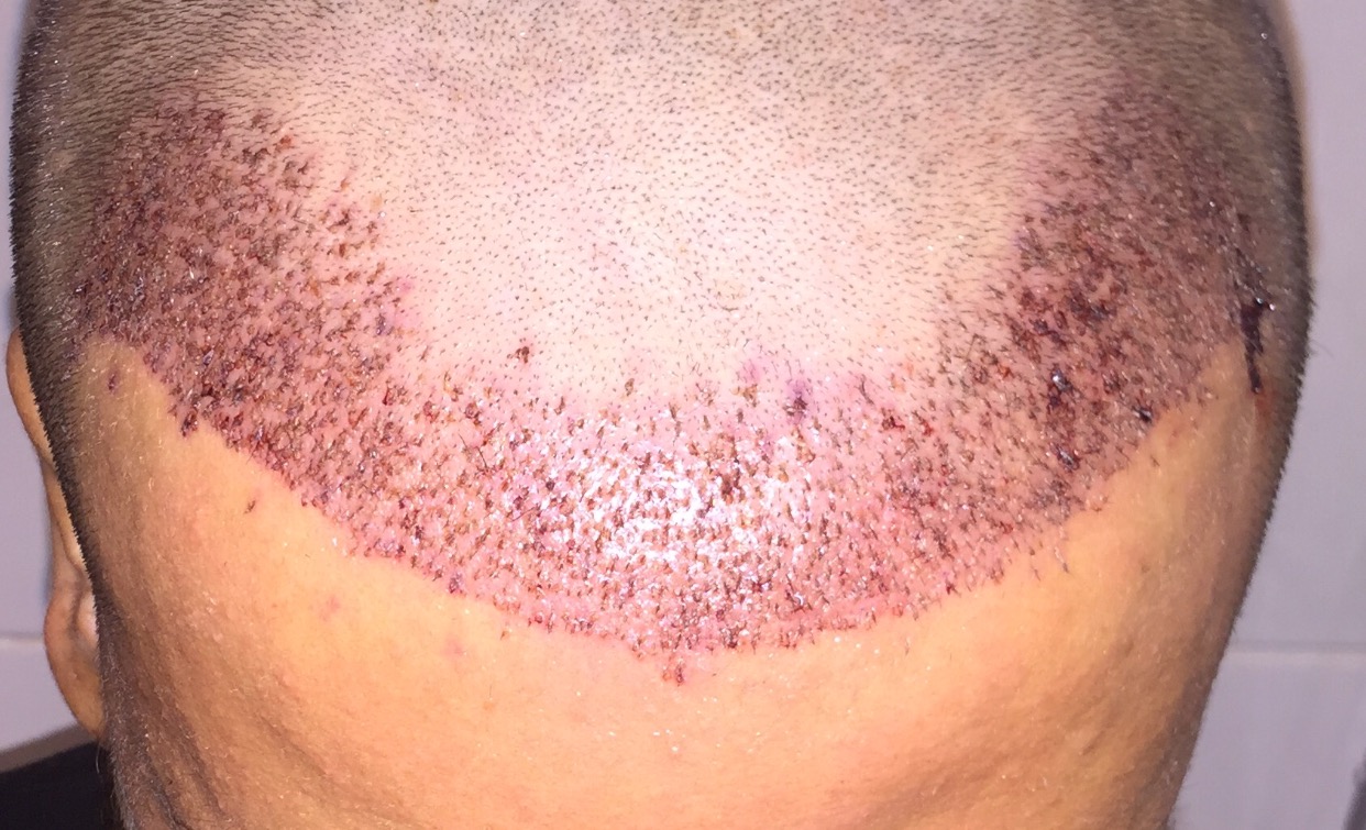 index.php/fa/31436/0/