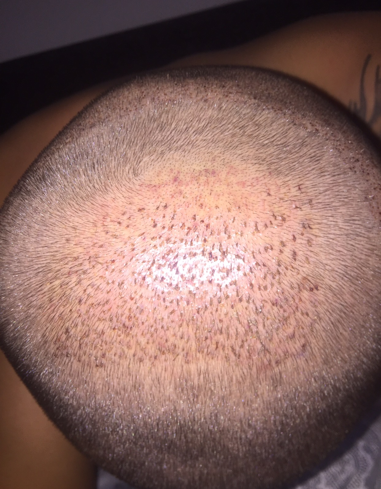 index.php/fa/31456/0/