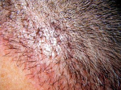 index.php/fa/3153/0/