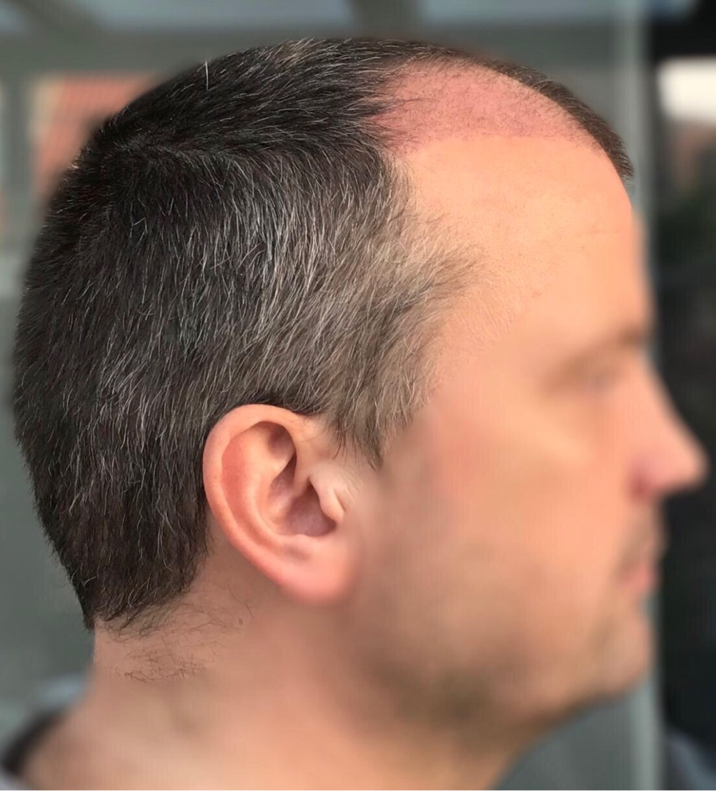 index.php/fa/31536/0/