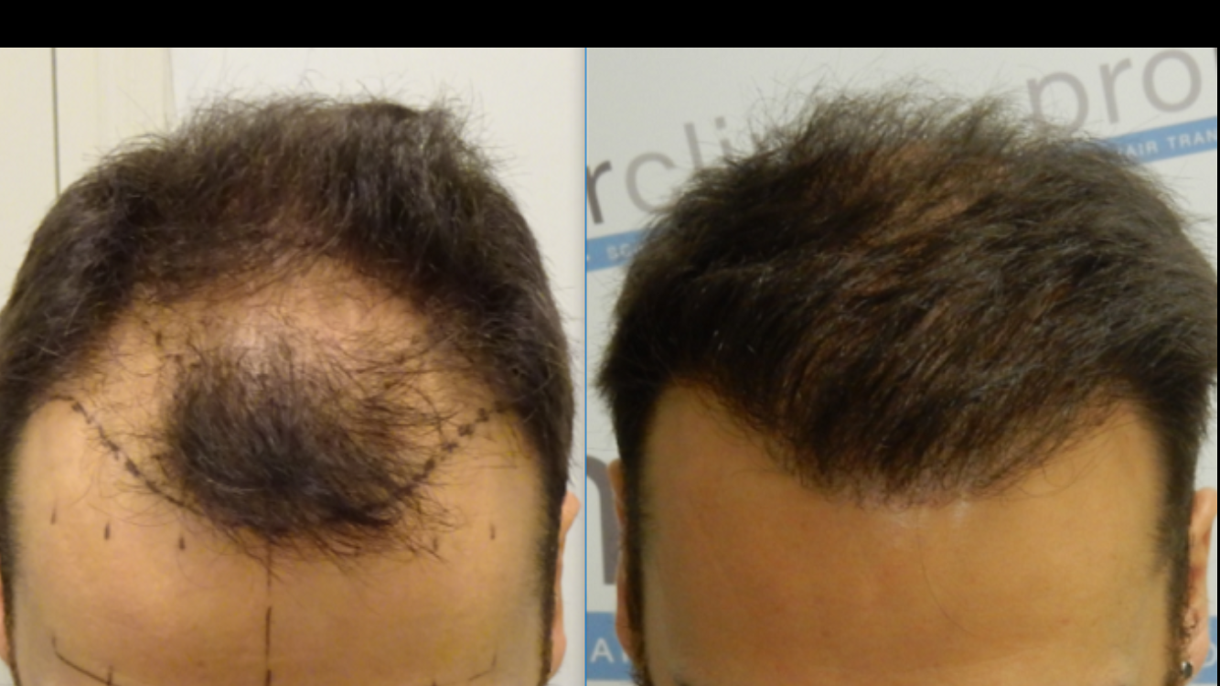 index.php/fa/31578/0/