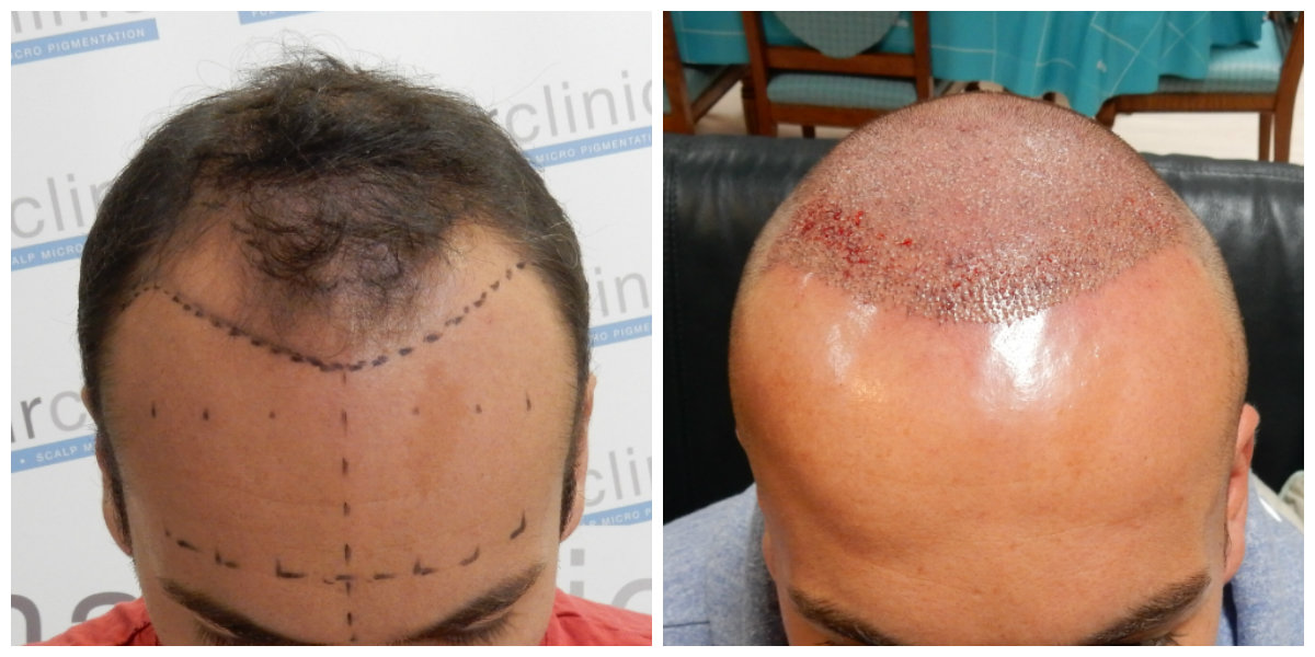 index.php/fa/31579/0/