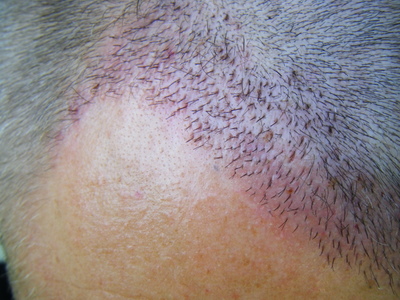 index.php/fa/3158/0/