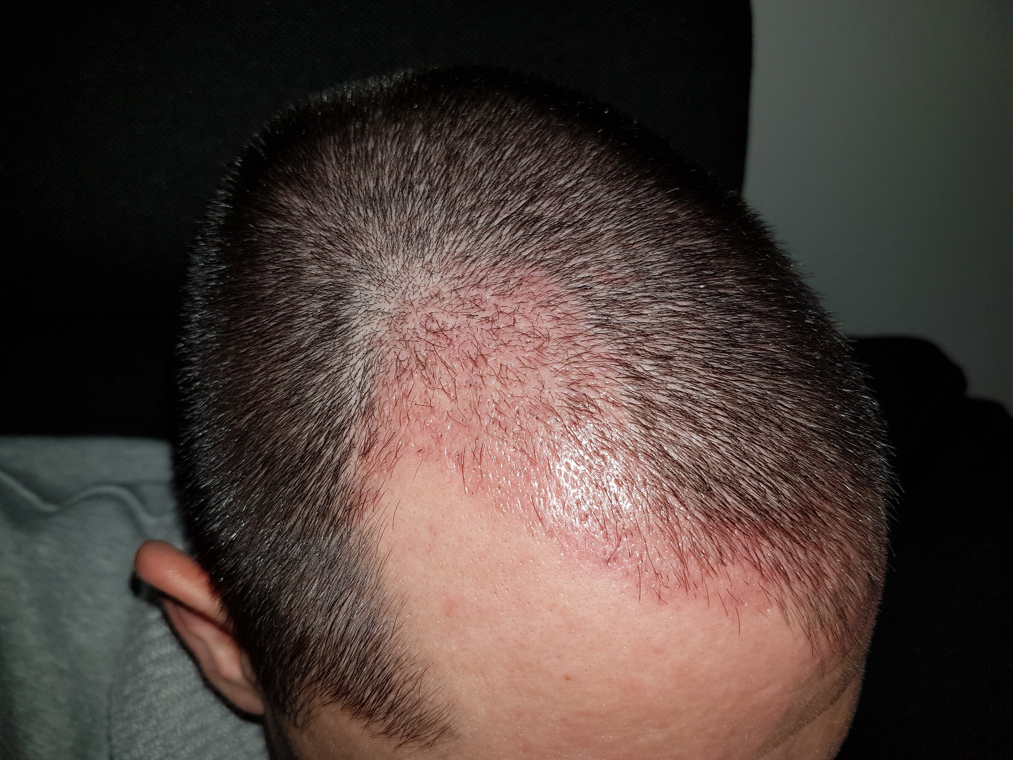 index.php/fa/31795/0/