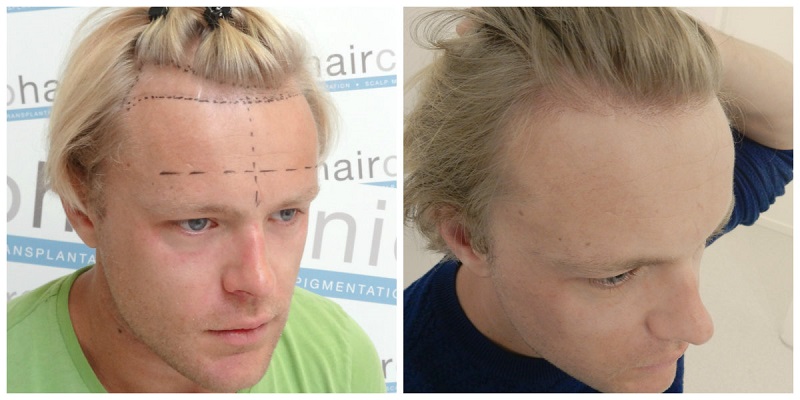 index.php/fa/31921/0/