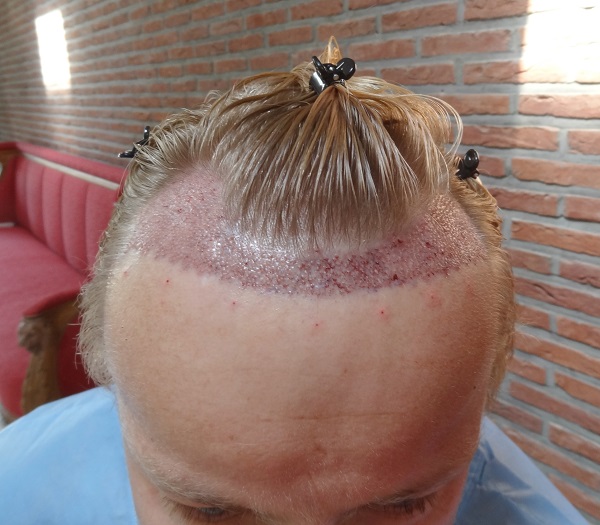 index.php/fa/31927/0/