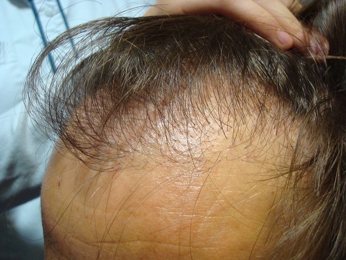 index.php/fa/31994/0/