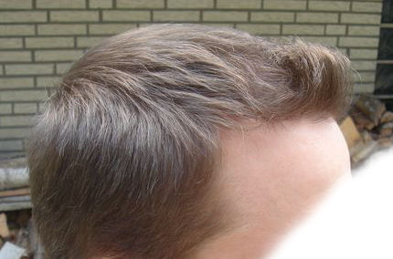 index.php/fa/3209/0/