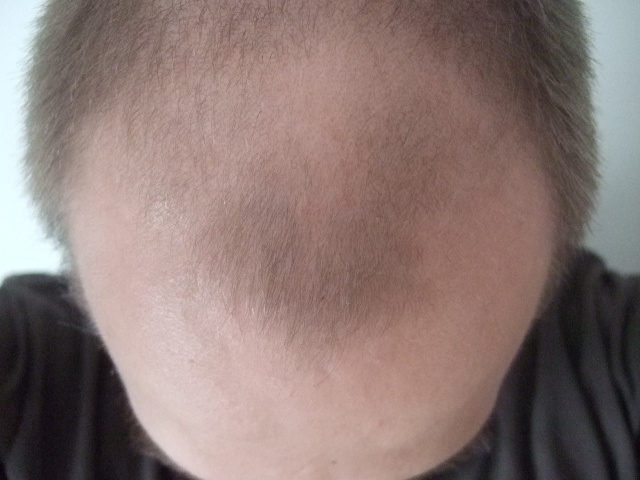 index.php/fa/3211/0/