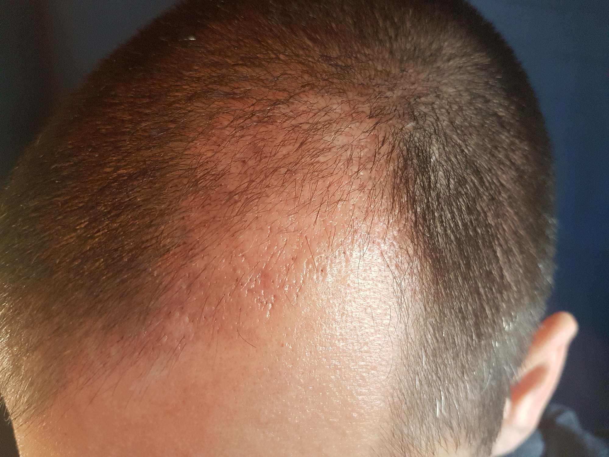 index.php/fa/32114/0/