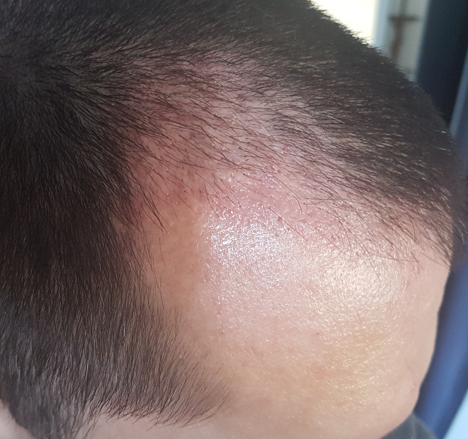 index.php/fa/32115/0/