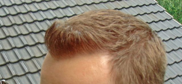 index.php/fa/3212/0/