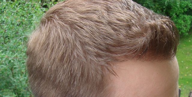 index.php/fa/3213/0/