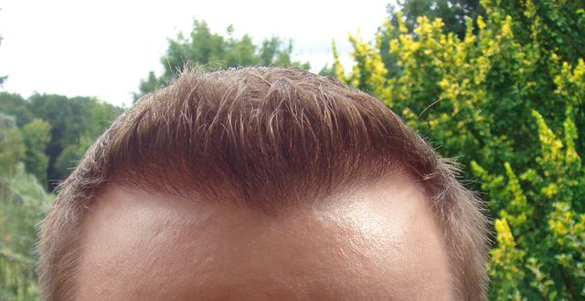 index.php/fa/3214/0/