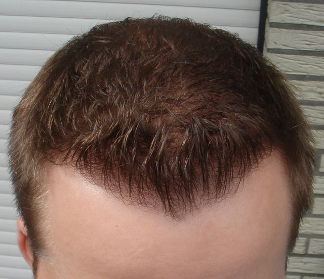 index.php/fa/3215/0/