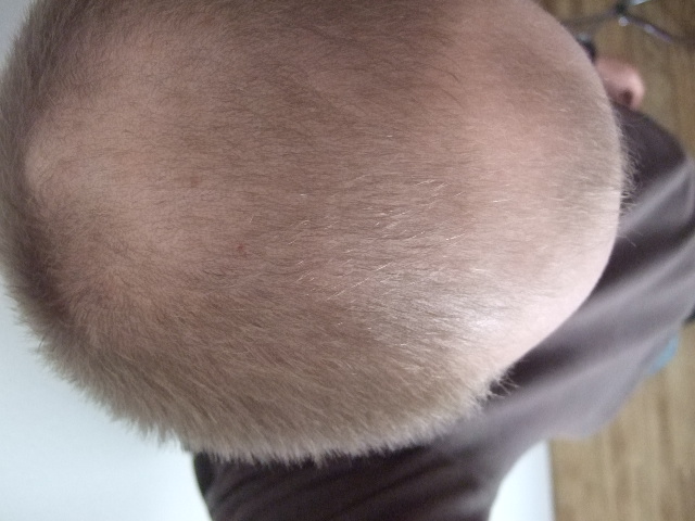 index.php/fa/3217/0/