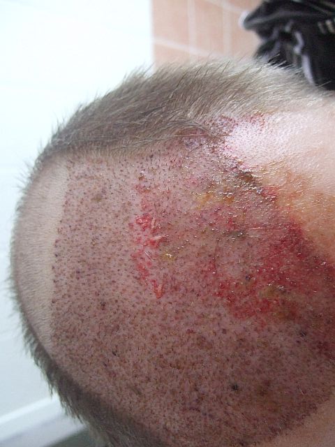 index.php/fa/3221/0/