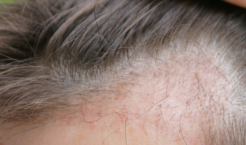 index.php/fa/3222/0/