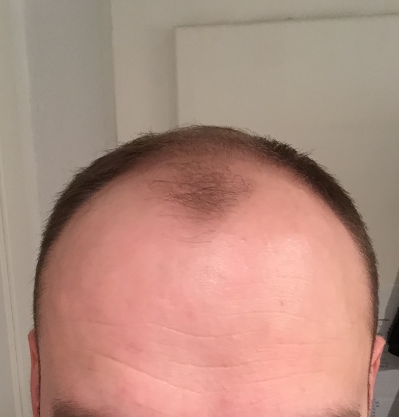 index.php/fa/32221/0/