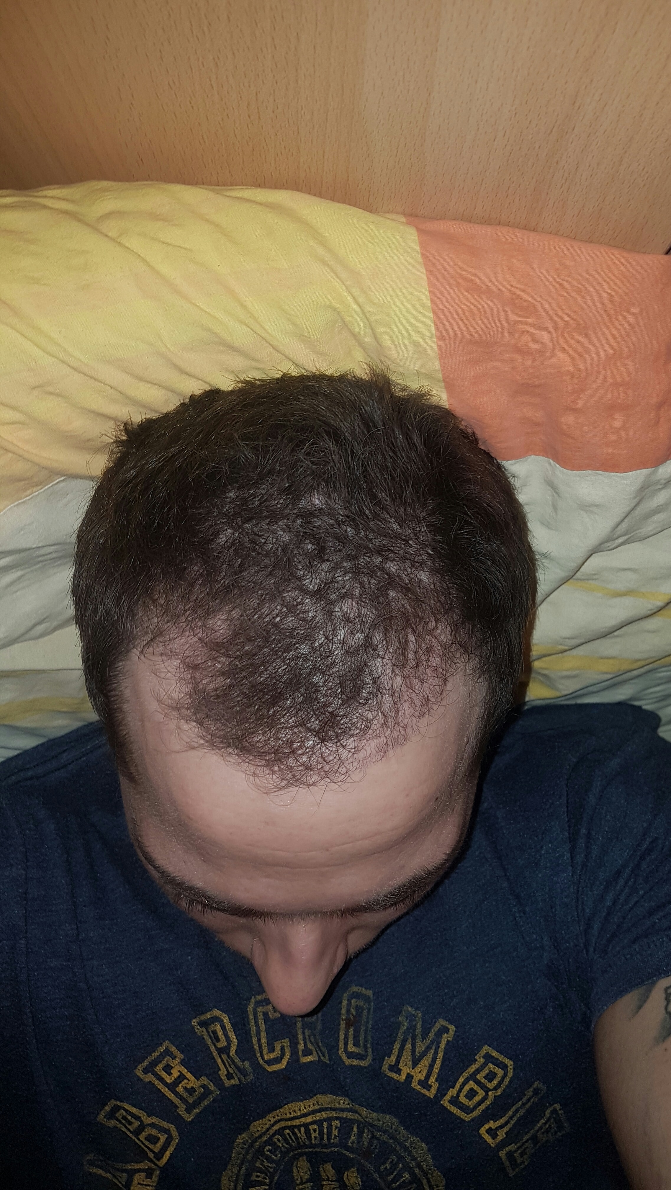 index.php/fa/32238/0/