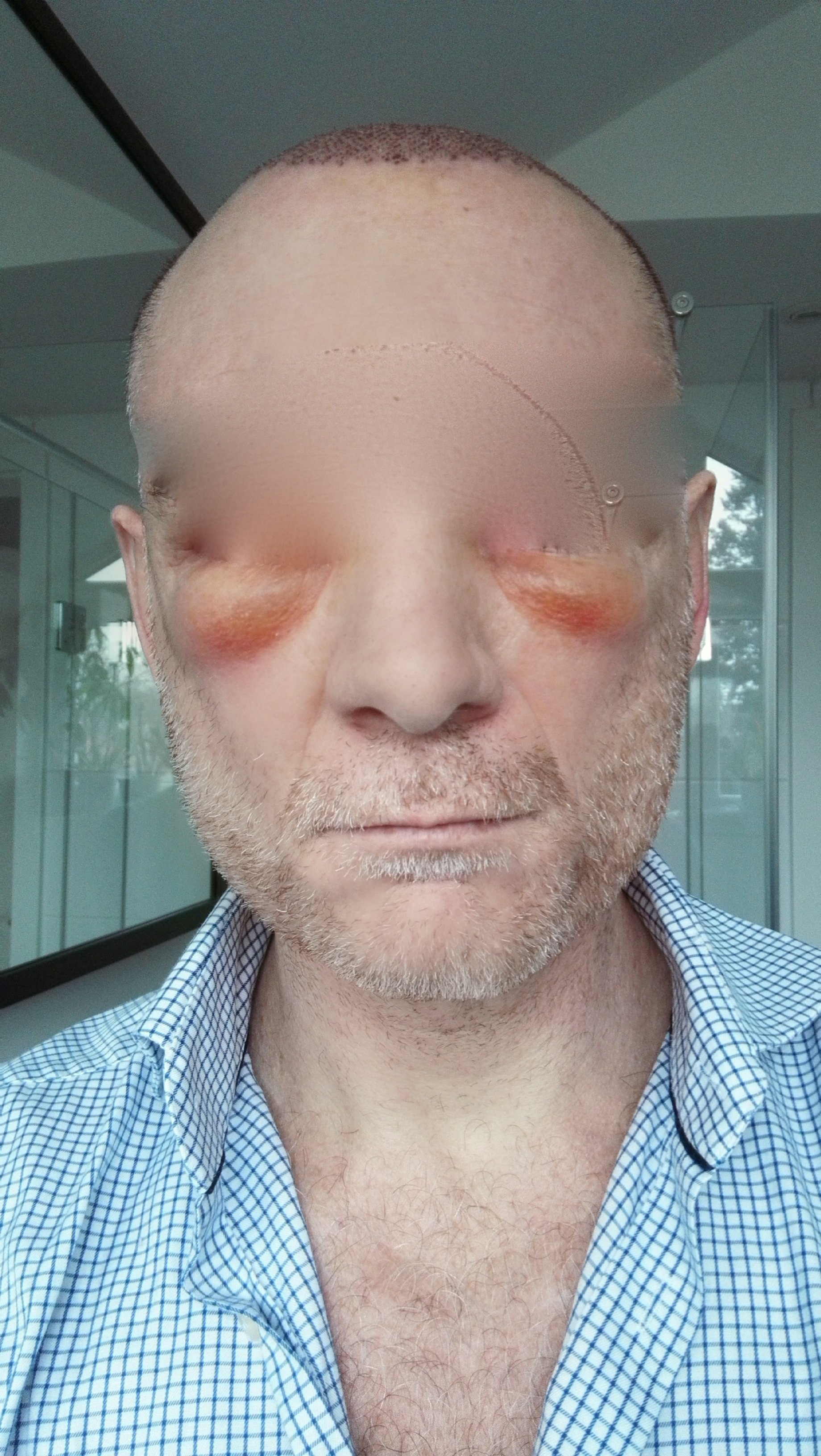 index.php/fa/32355/0/