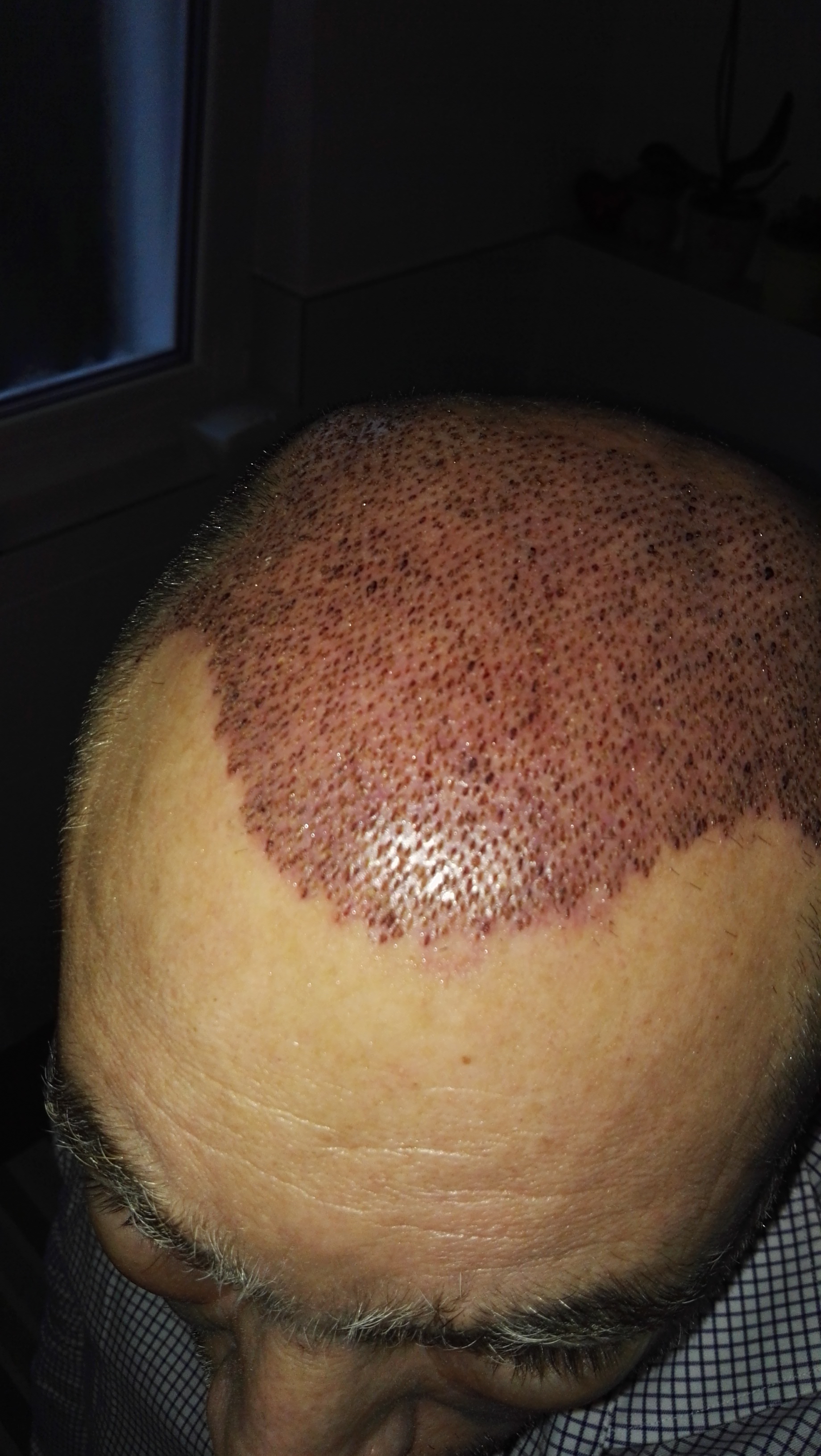 index.php/fa/32359/0/