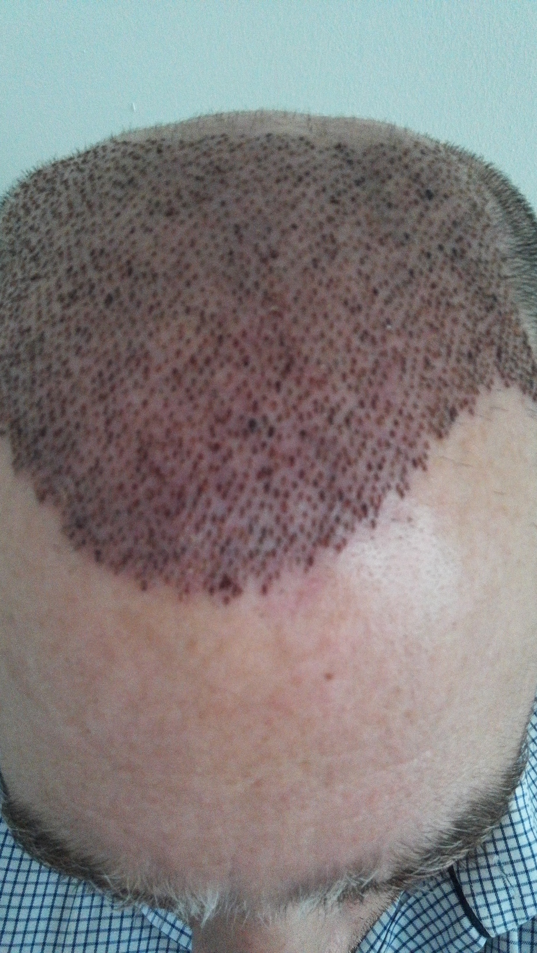 index.php/fa/32362/0/