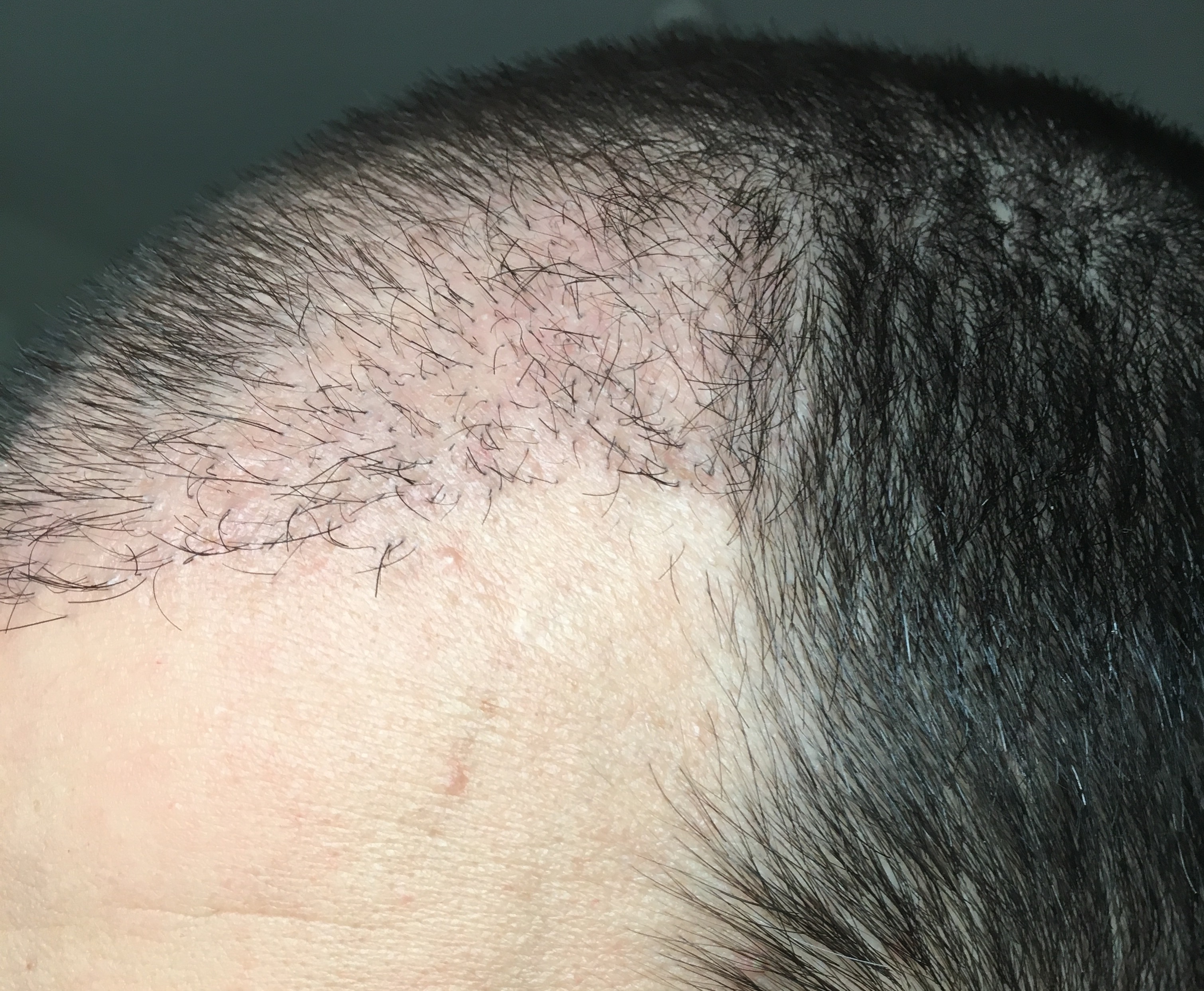 index.php/fa/32413/0/