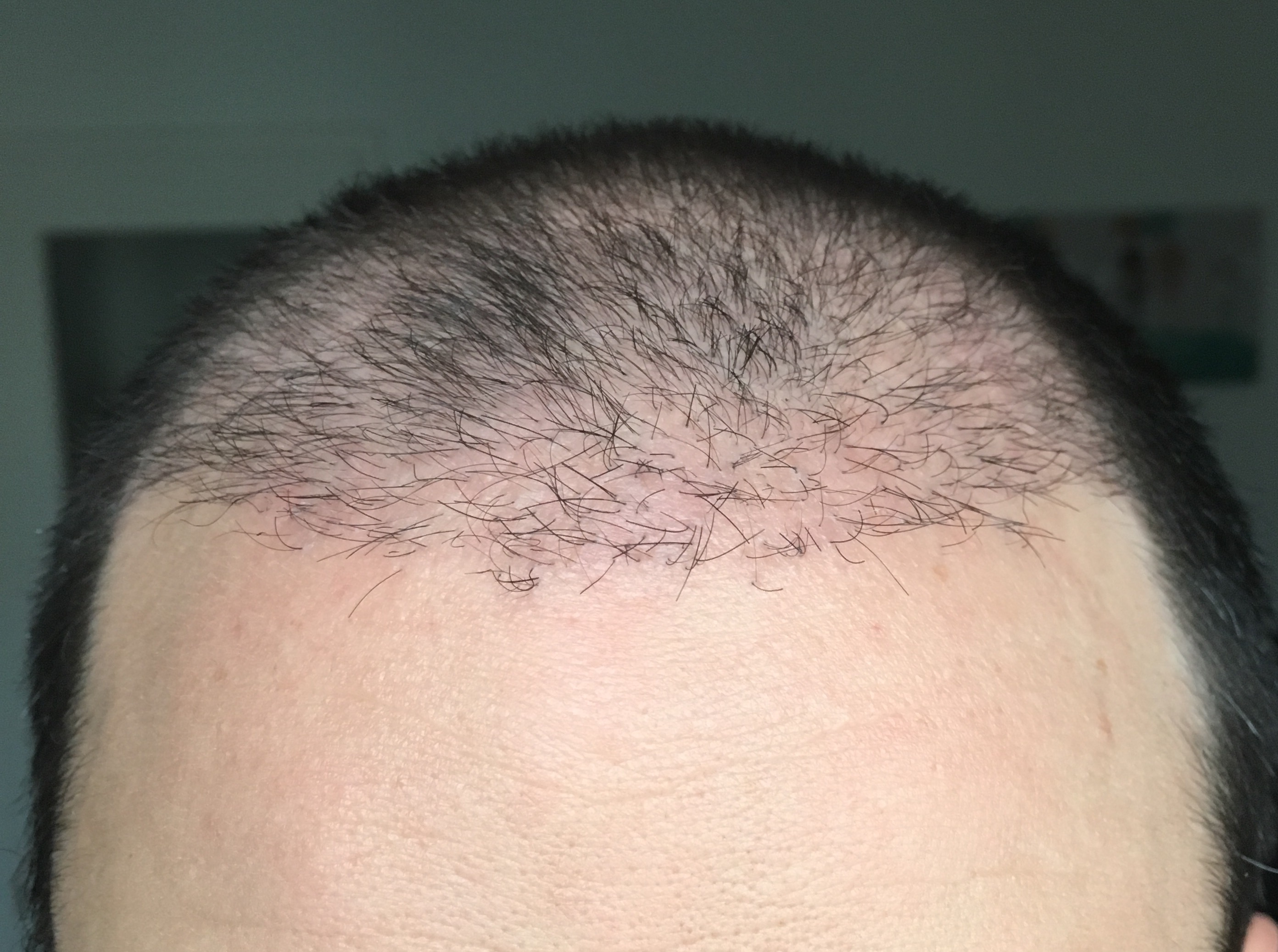 index.php/fa/32414/0/